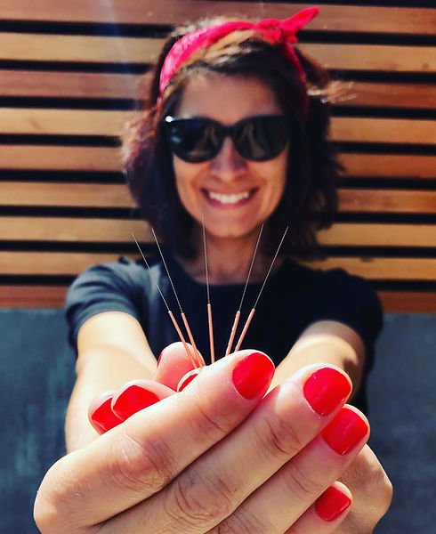 Fabi, qualified acupuncturist in Didcot, Oxfordshire
