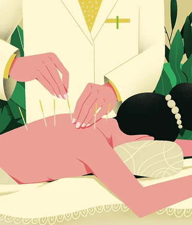 Acupuncture treatment with fine needles