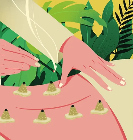 Moxibustion treatment using warming herb